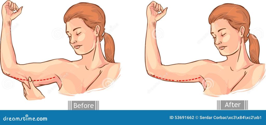 Content image for Handles Coming Loose Over Time? Tips to Secure Them Tight